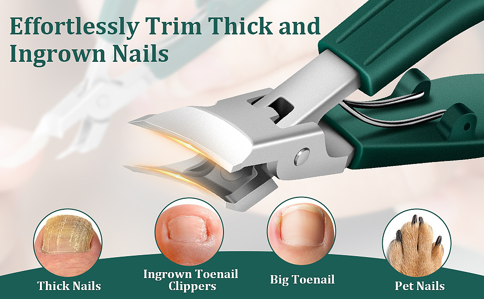 Effortlessly Trim Thick and Ingrown Nails