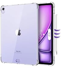 https://m.media-amazon.com/images/S/aplus-media-library-service-media/3181f8cd-b68e-47f1-8315-43fcbd58d468.__AC_SR200,225___.jpg
