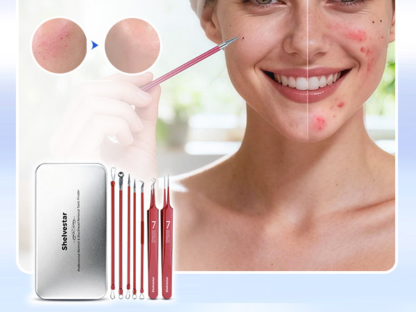 Pimple Popper Tool, Blackhead Remover Acne and Zit Comedone Extractor Kit
