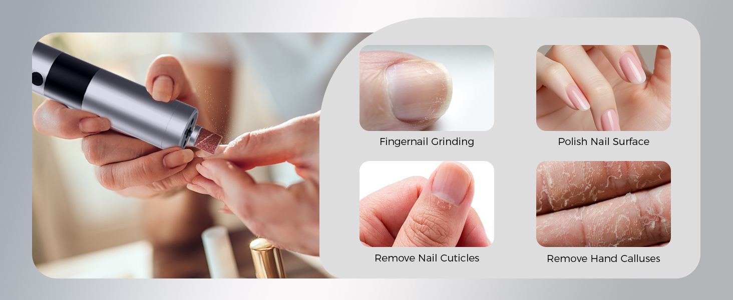 electric foot callus remover