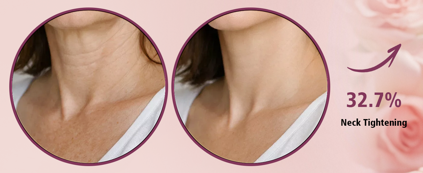 Neck Tightening