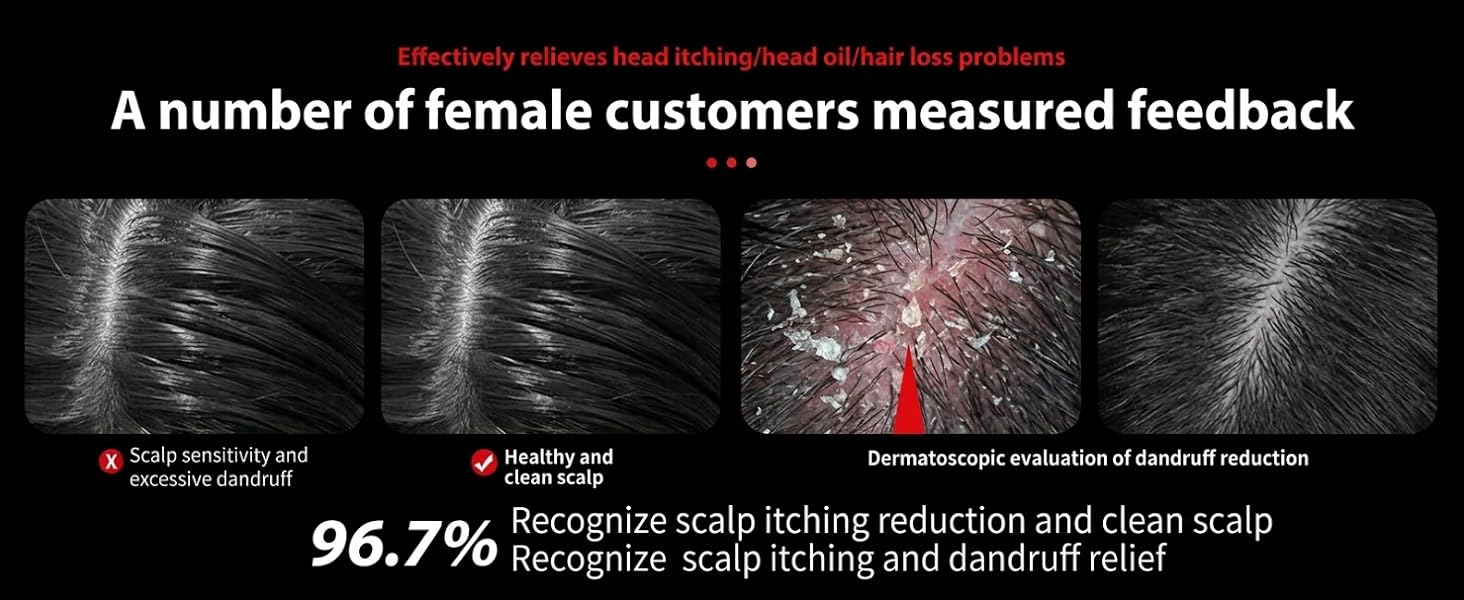 Scalp care results and dandruff reduction