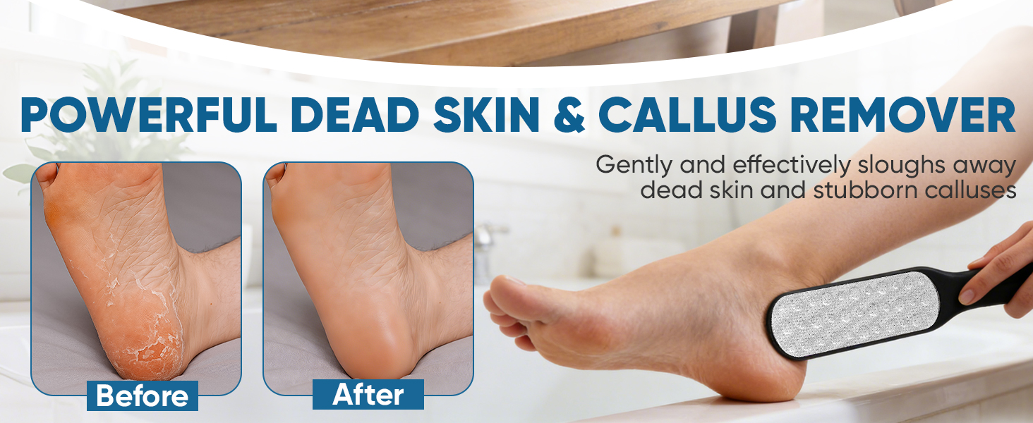 POWERFUL DEAD SKIN &amp;amp; CALLUS REMOVER