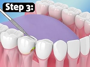 dental picks for teeth cleaning, dental care, dentist kit, teeth care, dental picks metal,