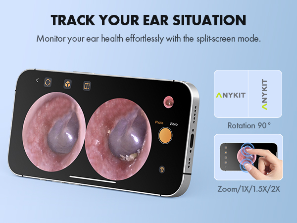 Otoscope