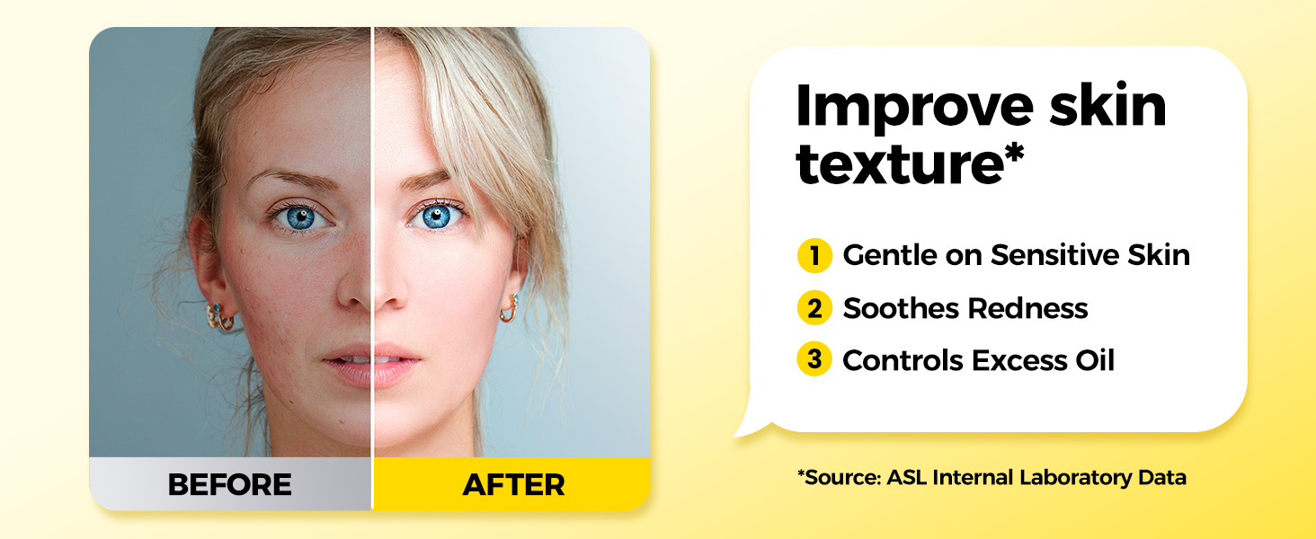 lImprove skin texture