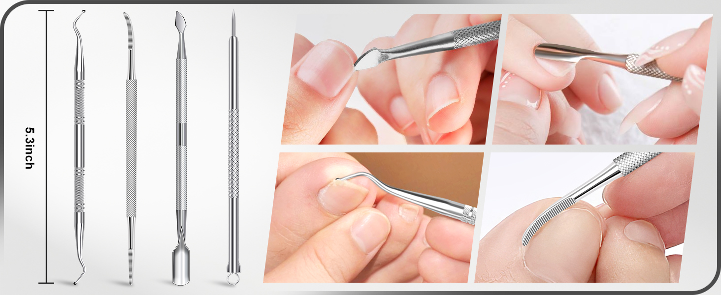 ingrown toenail tool