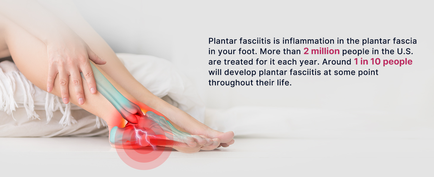PLANTAR FASCIITIS