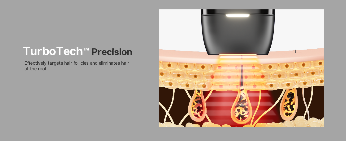 laser hair removal device