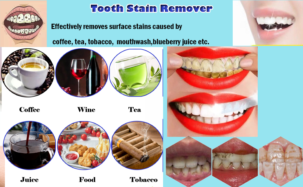 ?Tooth Stain Remover