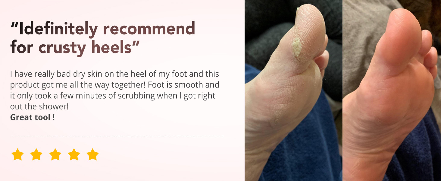 Foot Files 