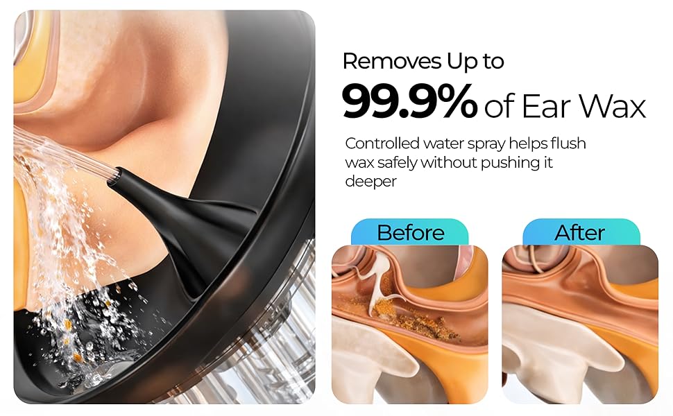 Earwax Removal Tools