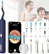 Ear Wax Removal Tool Camera with Wireless WiFi,Ear Wax Removal Tool with Flexible Visual 1080P Li...
