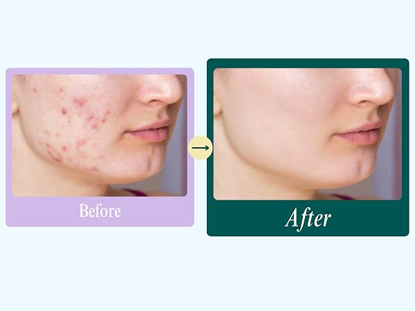 before and after 1