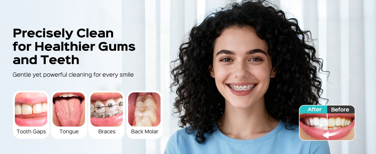 Portable Water Flosser