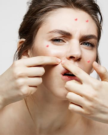 stainless steel pimple