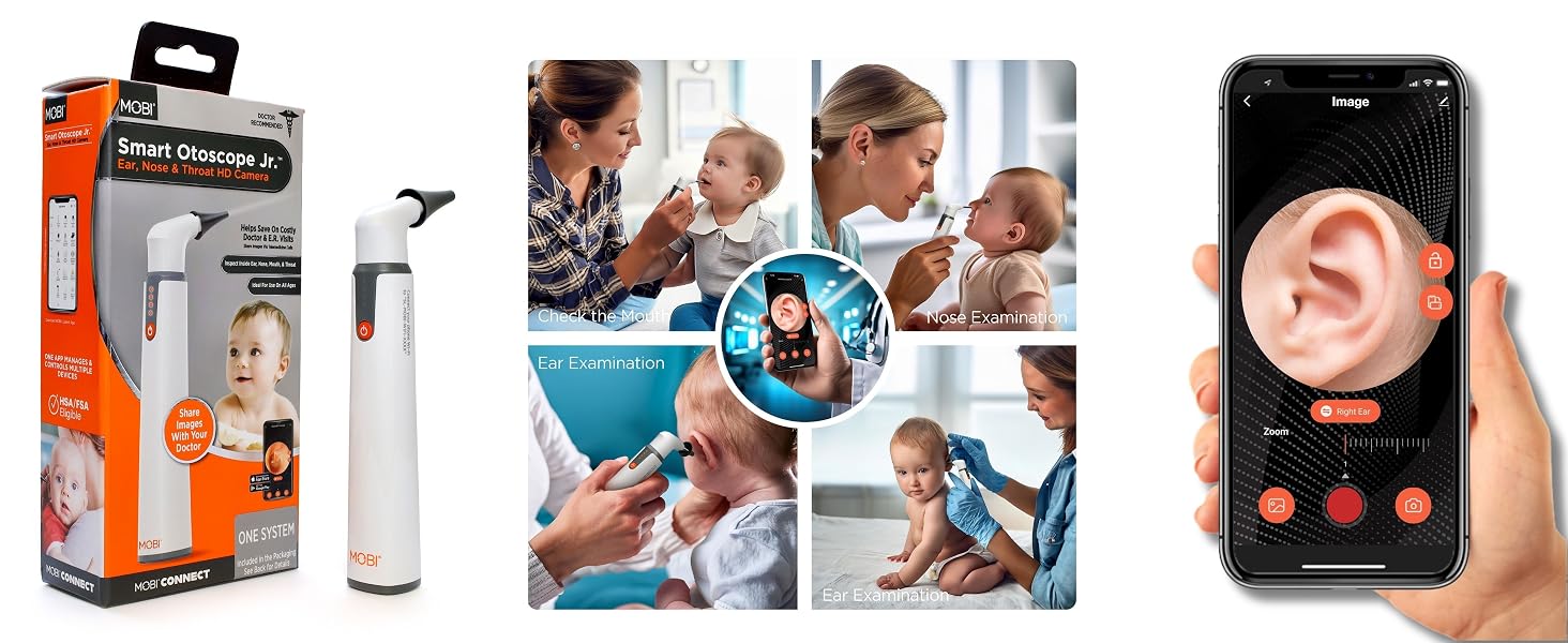 MOBI Smart Otoscope Jr. - High-Definition Digital Otoscope for ENT Exams with LED Lighting 