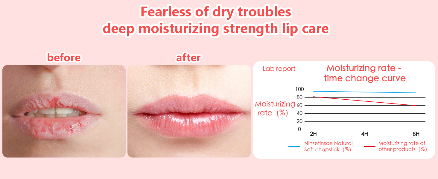 lip balms