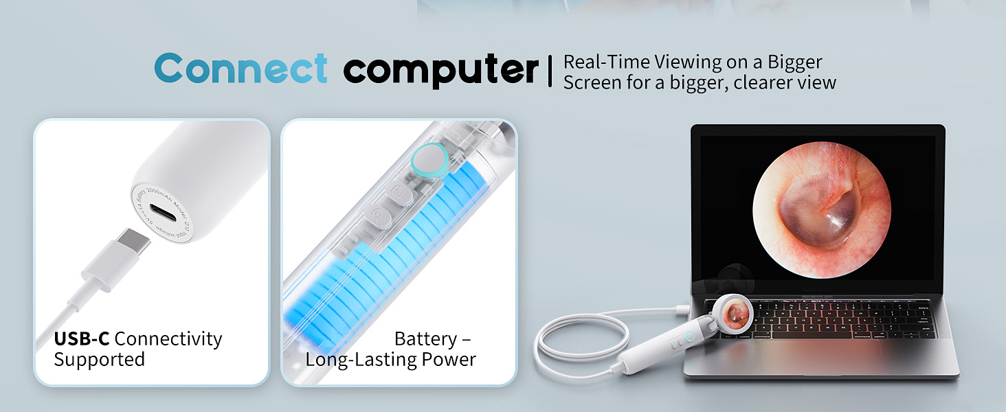 Otoscope
