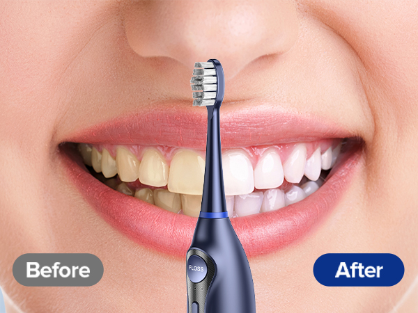 electric toothbrush with water flosser
