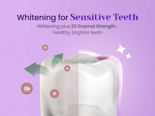 Whitening for Sensitive Teeth