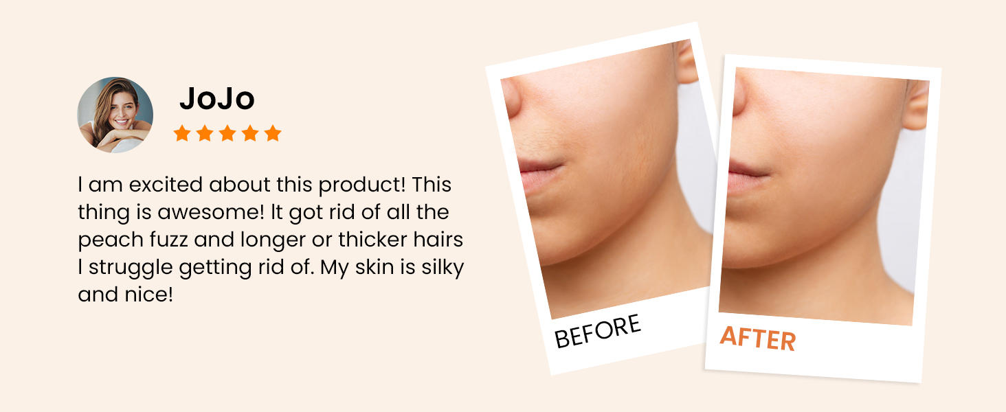 A11 REVIEW 2-flawless facial hair remover