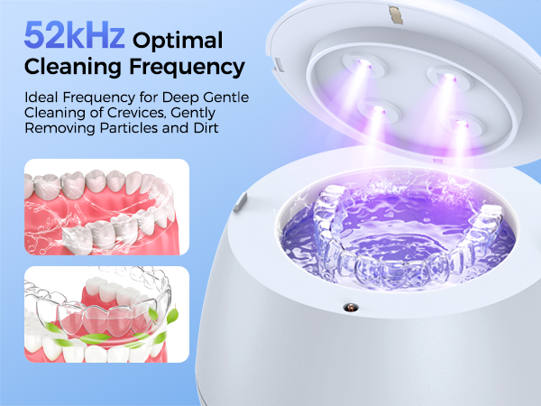 ultrasonic retainer cleaner