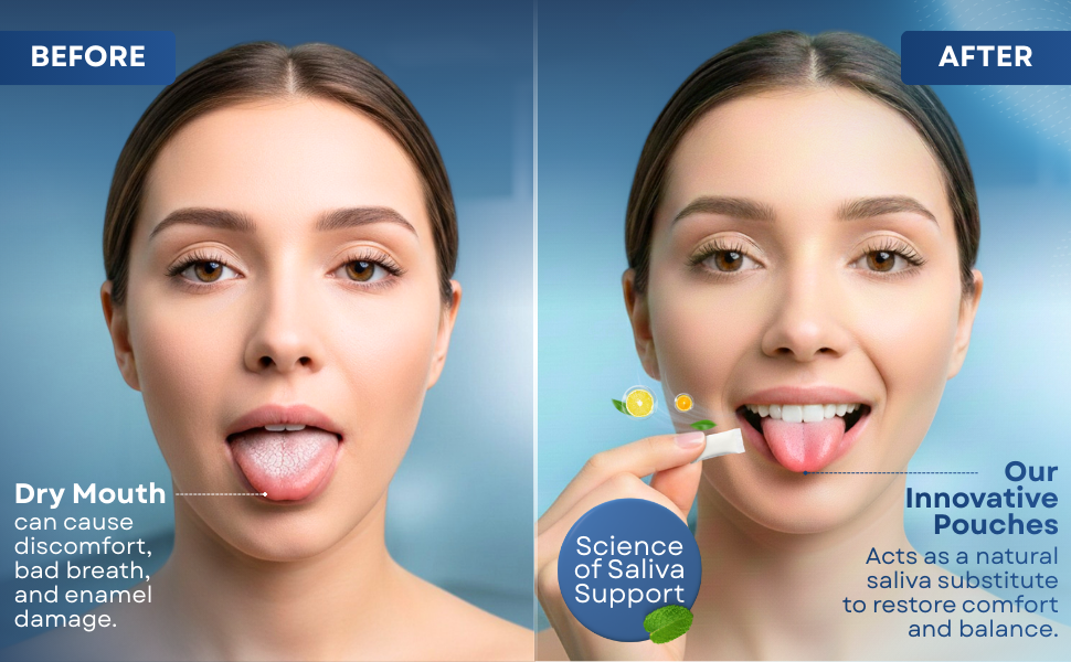 saliva substitute dry mouth