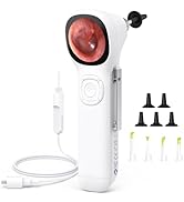 ScopeAround Digital Otoscope w/Built-in Screen, Manual-Focus Digital Otoscope with Light for Home...