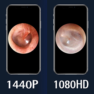 Ear Wax Removal Tool Camera