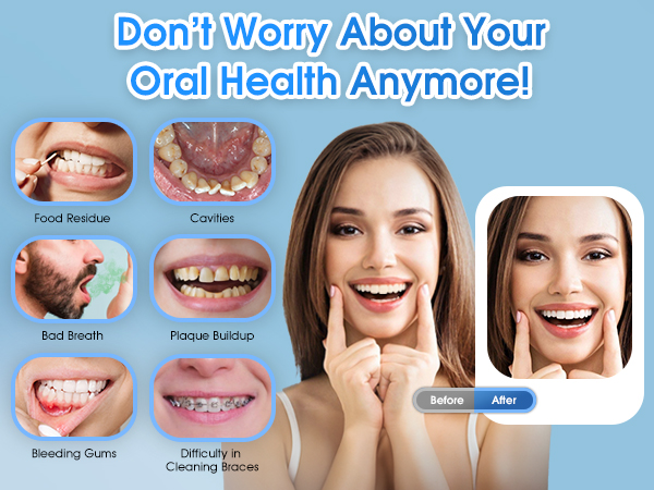 dental water flosser