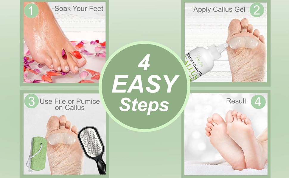 callus remover gel