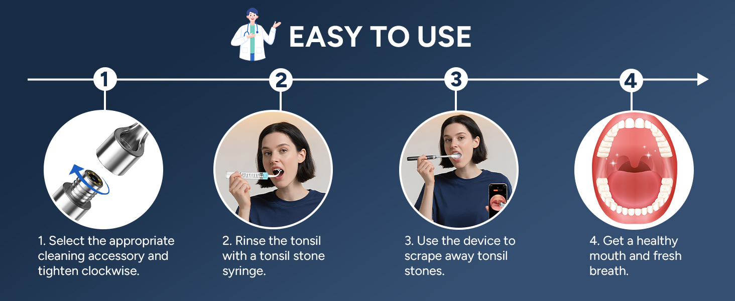 Tonsil Stone Remover with Camera