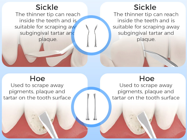 electric teeth cleaner