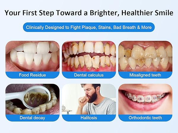 Water Dental Flosser for Teeth