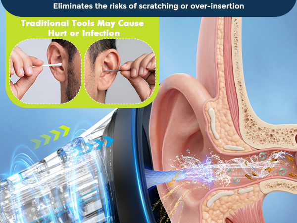 ear cleaning tool