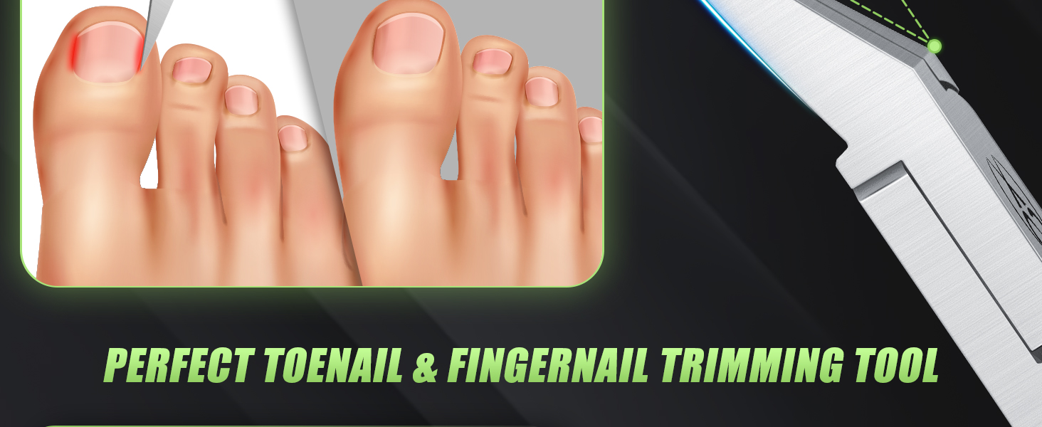 ingrown toenail clippers