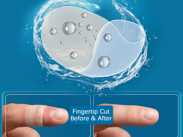 ADVANCED HYDROCOLLOID TECHNOLOGY ACCELERATED HEALING FOR DIVERSE WOUNDS (3)