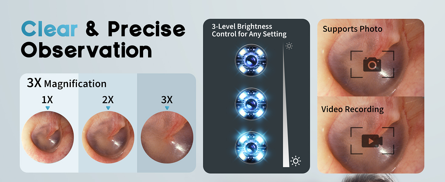Otoscope