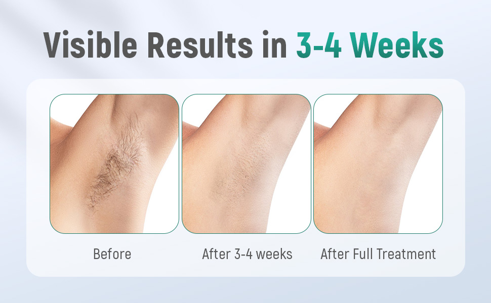 Visible Results in 3-4 Weeks