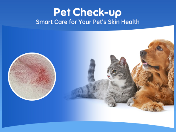 ear cleaner earwax removal