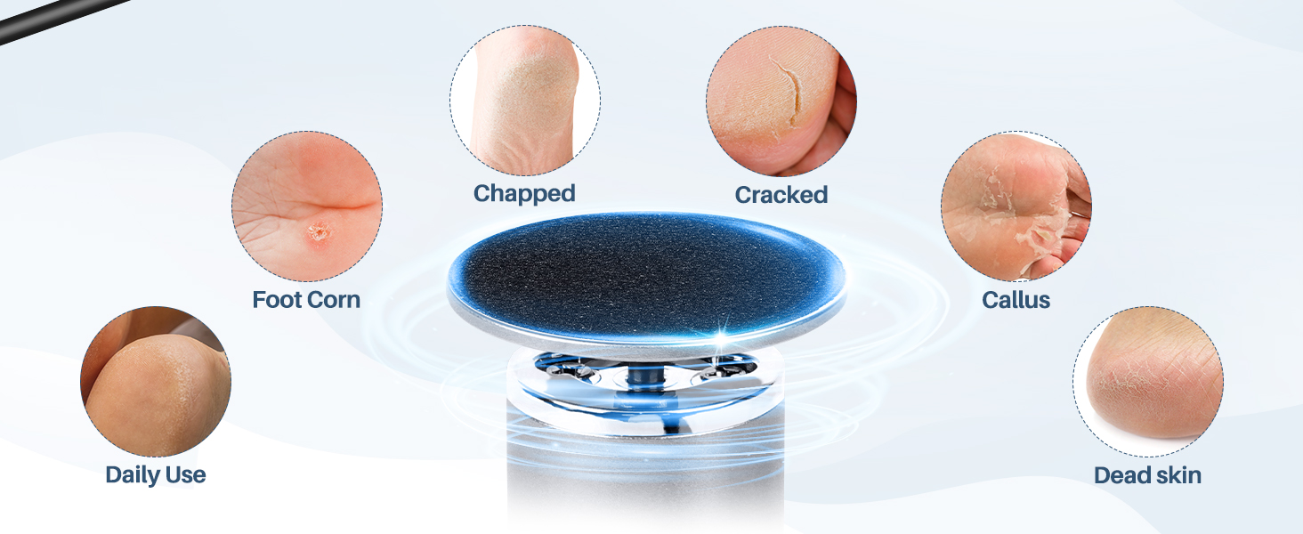 Suitable for different types of foot problems