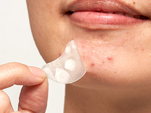 Leave on 4-6 hours.Remove the patch with gunk and moisturize the area.