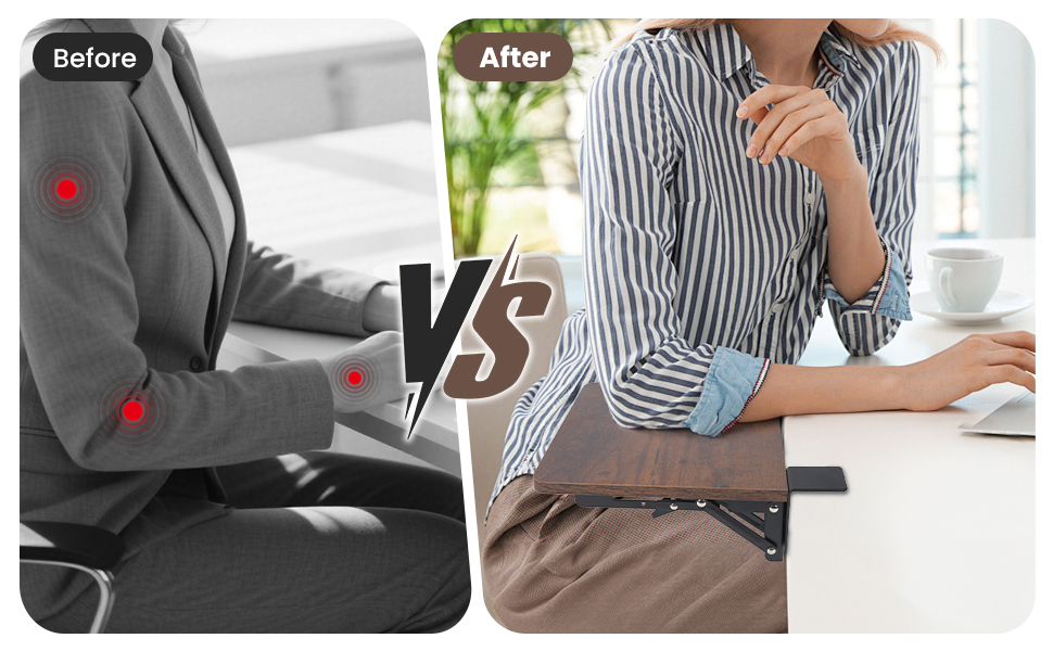Elbow Arm Rest tray
