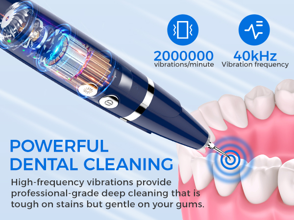 plaque remover