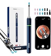 Ear Wax Removal Tool with 10 Megapixel Ear Camera, Note 5 Ear Wax Removal Kit with 12 Pcs Ear Sco...