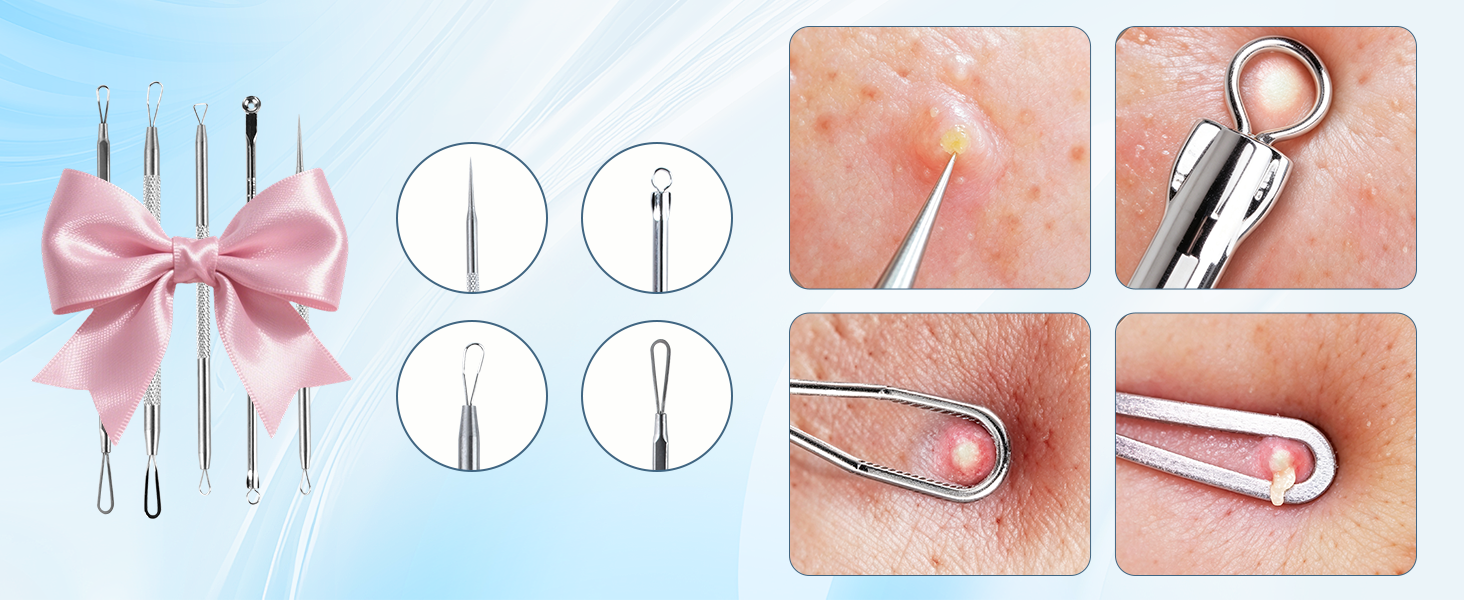 blackhead extractor