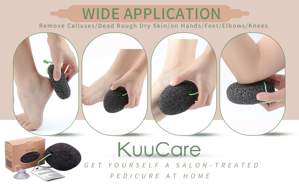 The Pumice Stone are Widely Used on Heels/Feet/Elbows/Hands/Knees, any calluses parts of your body