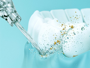 Advanced Periodontal Protection