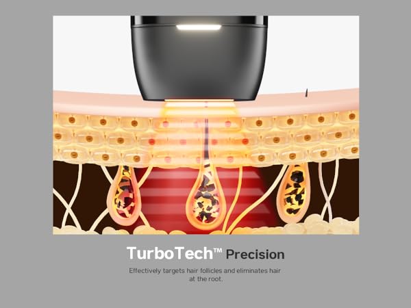 laser hair removal device